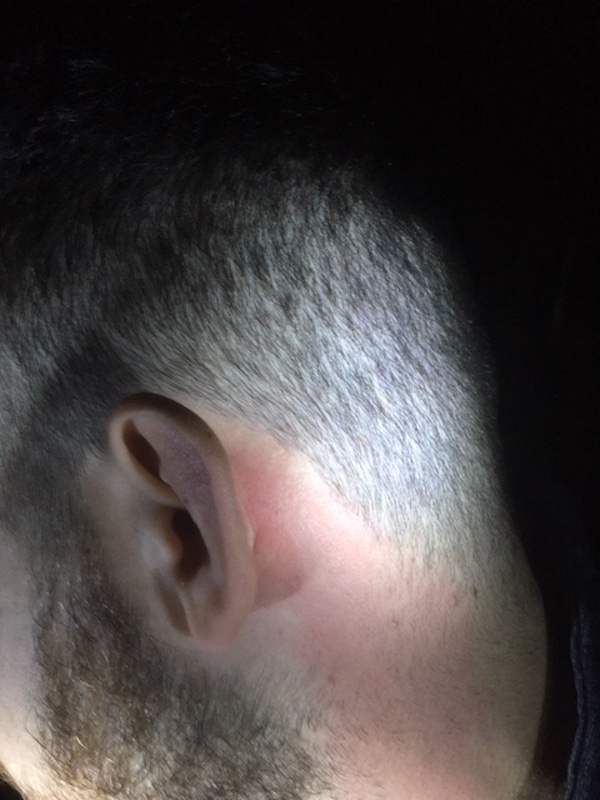 BURNED 1EAR 2021 BURNED 1EAR 2021