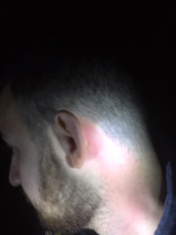 BURNED2 EAR 2021 BURNED2 EAR 2021