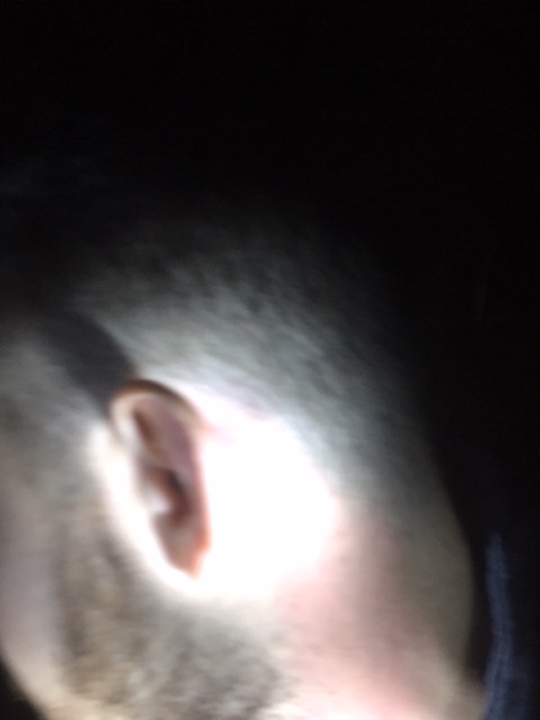 BURNED 5 EAR 2021 BURNED 5 EAR 2021